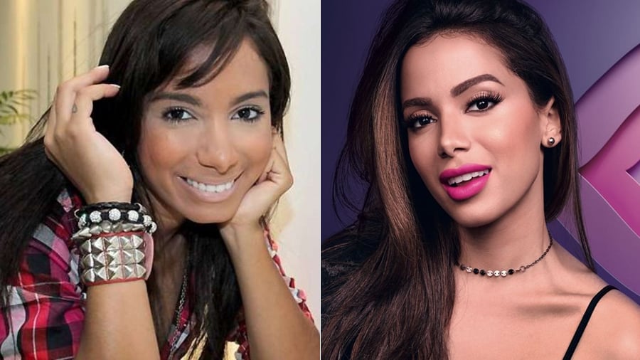 Anitta: antes e depois
