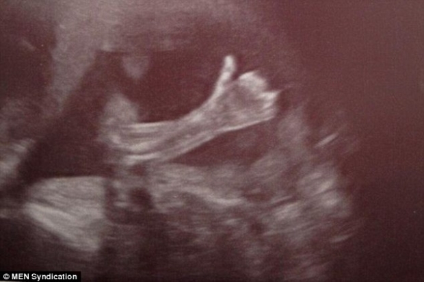 Mundo Positivo Dez Coisas Que O Bebe Pode Fazer Dentro Da Barriga Da Mamae Mundo Positivo