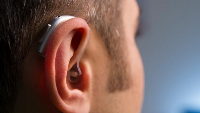 Aparelho auditivo inovador será capaz de filtrar vozes usando IA - 1