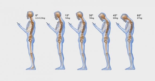 Cientistas acreditam que uso de smartphones está alterando o formato do crânio - 3