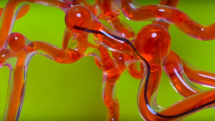 A cura do AVC? Cientistas criam verme robótico que viaja pelo cérebro - 1