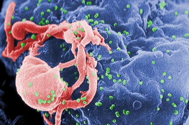 Cientistas criam microimplante para tratamento do vírus HIV - 2