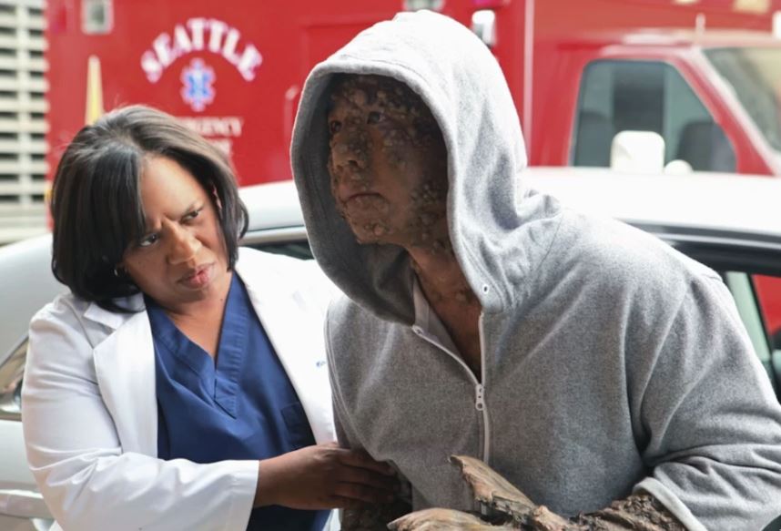 Grey’s Anatomy: As tramas mais bizarras inspiradas em casos médicos da vida real - 3