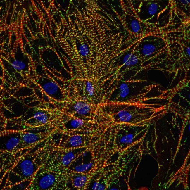 Células cardíacas sofrem alterações genéticas em ambientes de microgravidade - 3