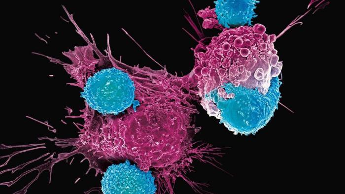 Combate ao câncer | 4 novas tecnologias promissoras para o tratamento da doença - 1