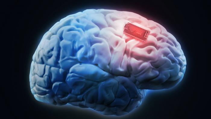 Médicos testam implantes cerebrais na luta contra dependência química - 1