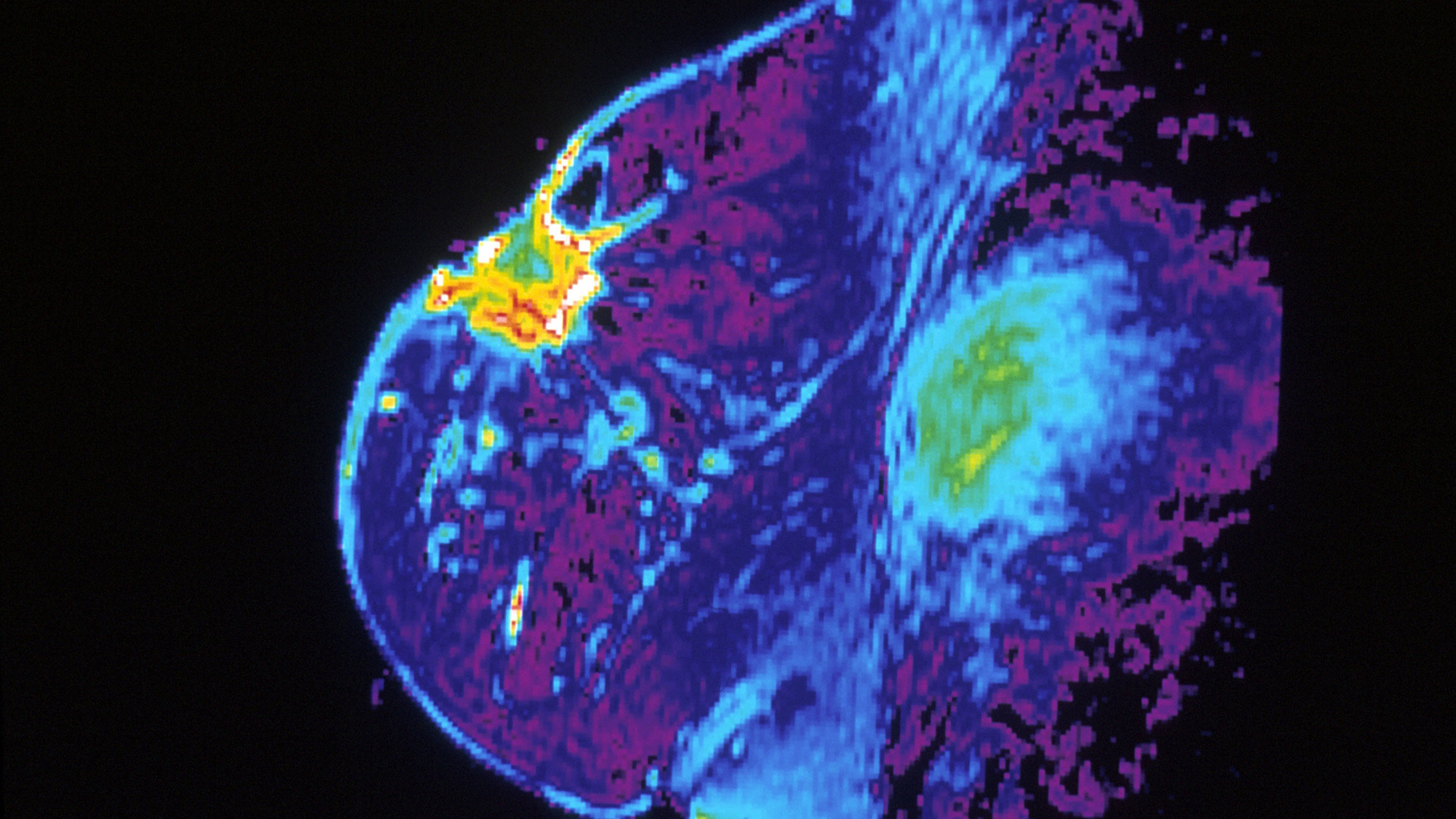 Mais rápida e precisa, IA ajuda na identificação de câncer de mama - 2