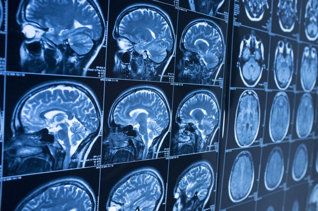 Biópsias feitas por IA têm taxa de sucesso equiparável à de médicos, diz estudo - 2