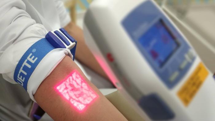 Medo de agulha? Scanner de veias facilita na hora do exame de sangue - 1