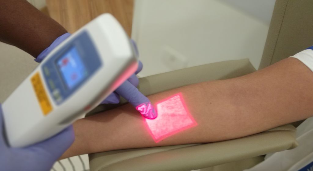 Medo de agulha? Scanner de veias facilita na hora do exame de sangue - 3