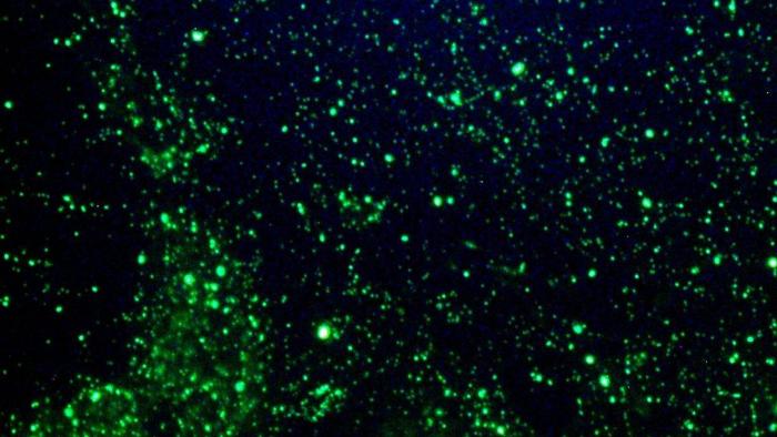 Com amostra de saliva, novo exame revela presença de coronavírus em 15 minutos - 1