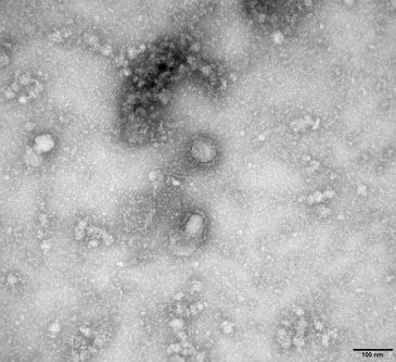 Imagem de microscopia eletrônica de transmissão do primeiro caso isolado do coronavírus Reuters / Direitos Reservados. 