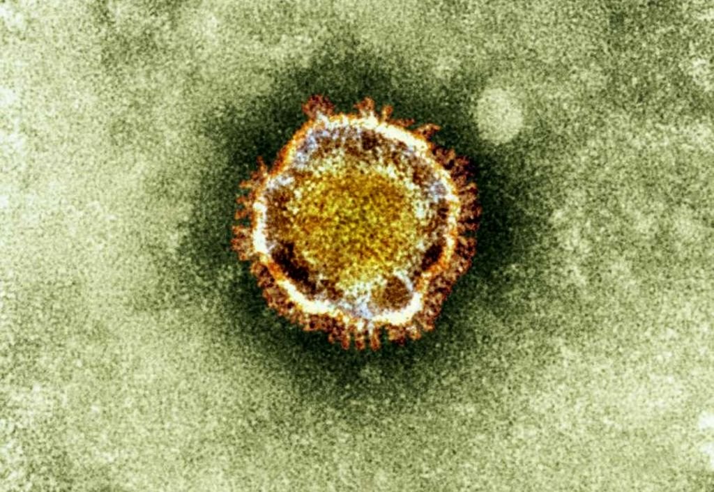 Coronavírus x H1N1: por que não dá para comparar as duas pandemias? - 2