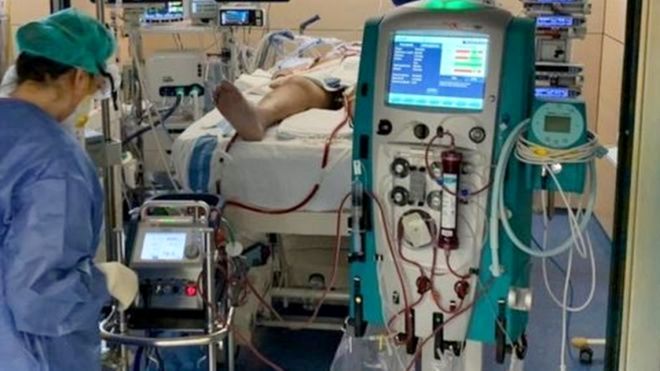 Tecnologia oxigena o sangue fora do corpo para ajudar vítimas da COVID-19 - 2
