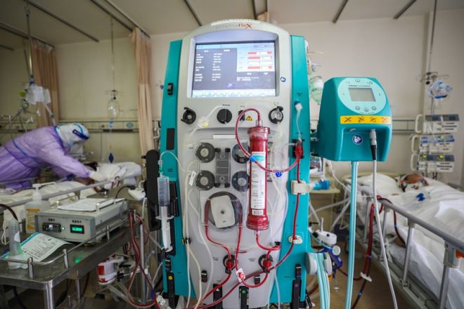 Tecnologia oxigena o sangue fora do corpo para ajudar vítimas da COVID-19 - 3