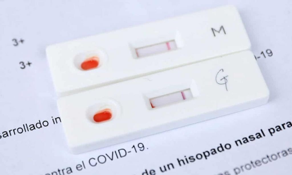 Coronavírus | Ministério da Saúde muda critérios para notificação da COVID-19 - 3