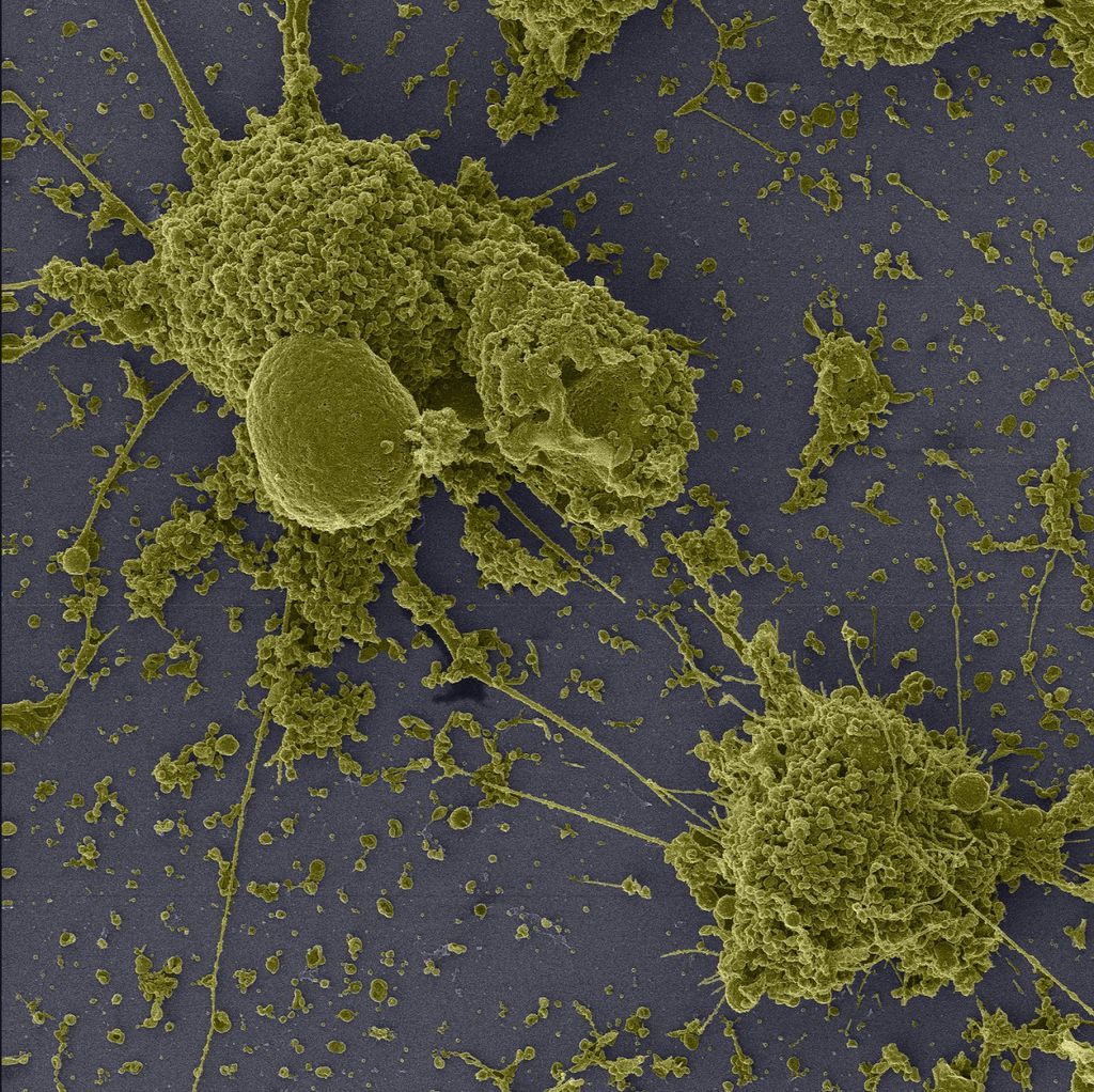 Mega zoom de 200 mil vezes! Veja imagens do coronavírus em ação nas células - 2