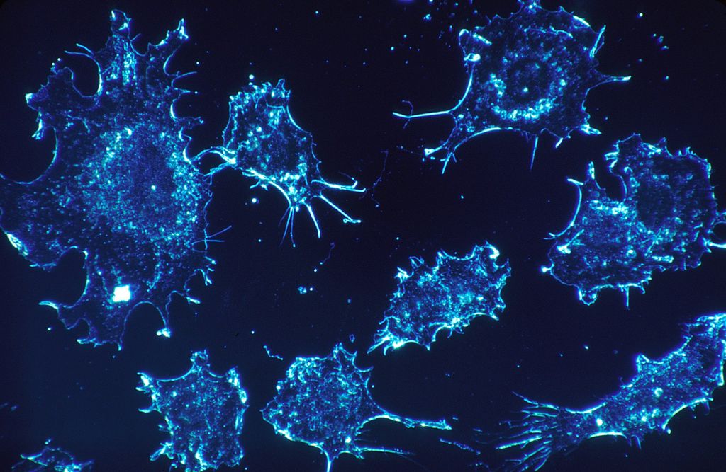 Vírus modificado consegue fazer tumores atacarem a si mesmos - 2
