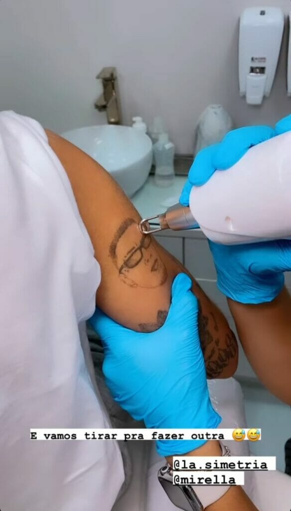 Após separação, MC Mirella ‘apaga’ passado com Dynho Alves e remove tatuagem com rosto do cantor - 2