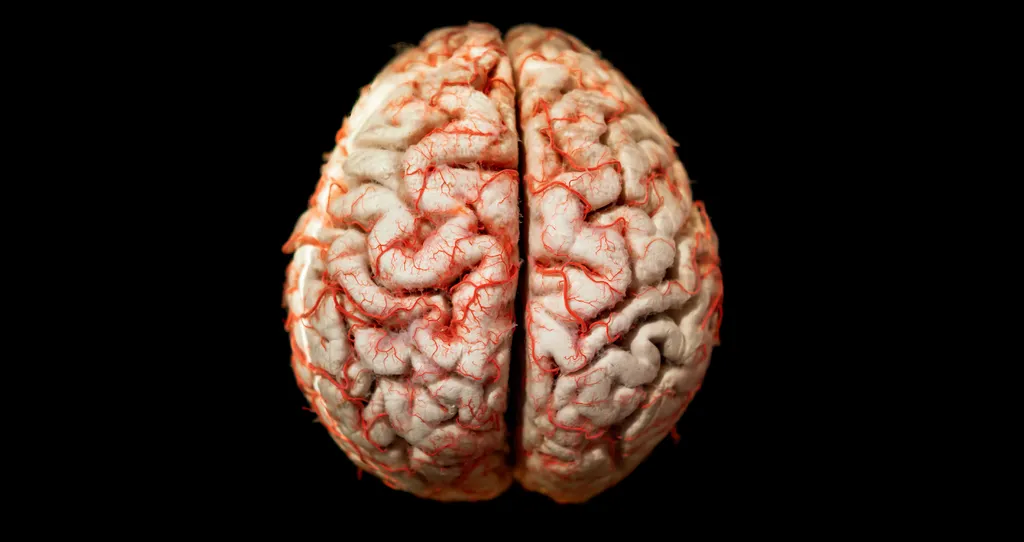 Eis o que acontece com seu cérebro enquanto você pratica atividade física - 2