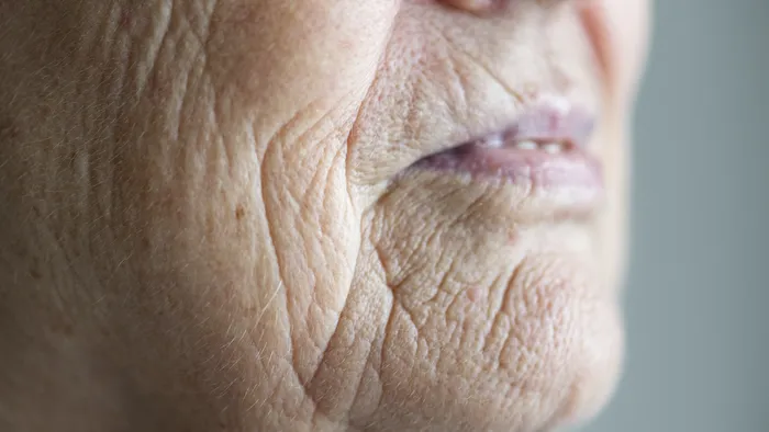 A causa do Alzheimer pode vir de dentro da boca, sugere estudo - 1