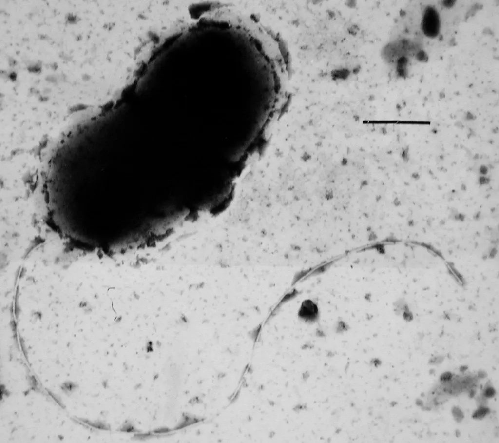Um exemplar de Desulfovibrio vulgaris, bactéria que pode ser a principal causa ambiental para o desenvolvimento do mal de Parkinson (Imagem: Graham Bradley/Domínio Público)