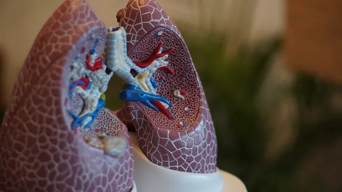 Câncer no pulmão: órgão é retirado para cirurgia e depois recolocado - 1