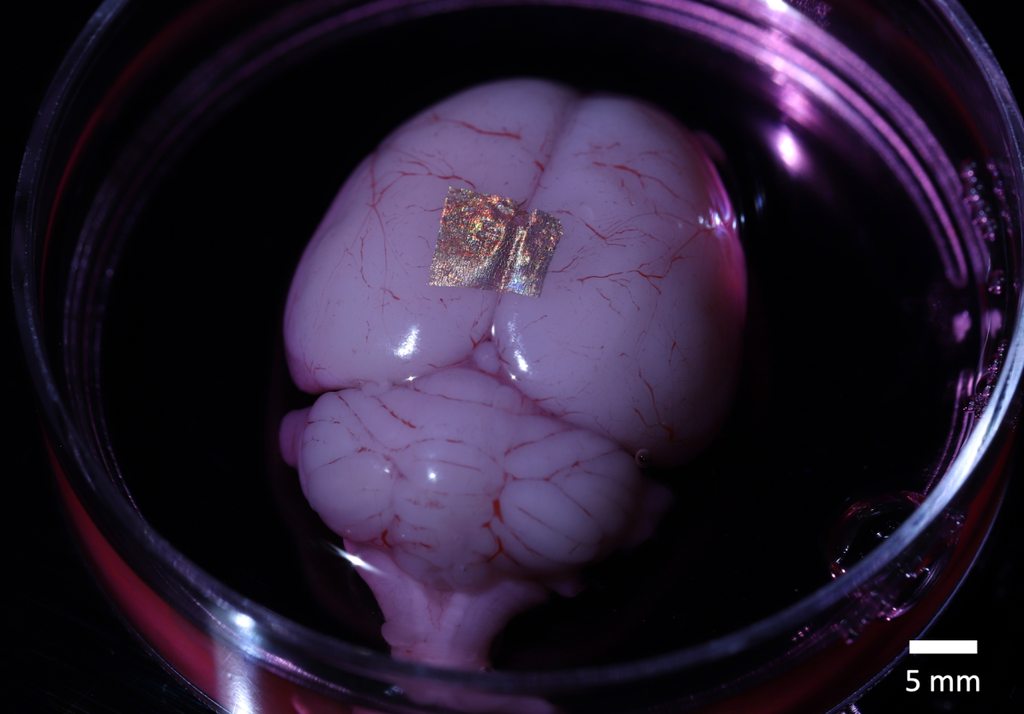 Por que cientistas tatuam células e órgãos com ouro? - 3