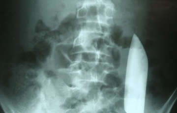 post-image