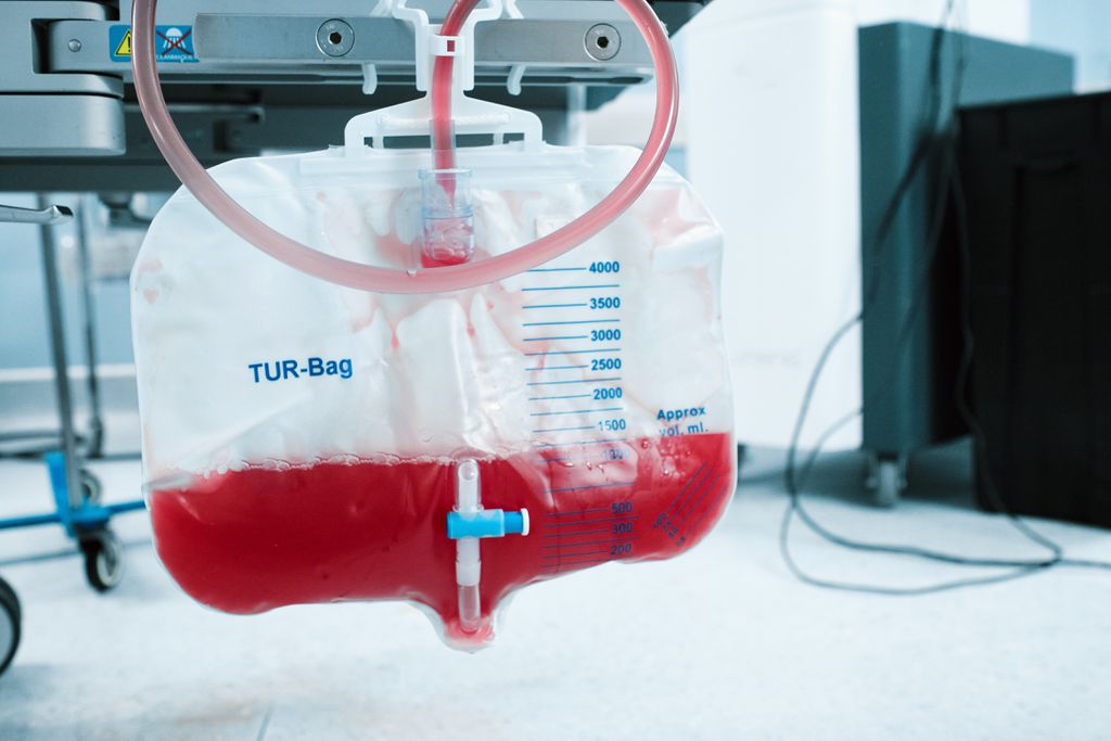 PEC do Plasma: entenda a polêmica da