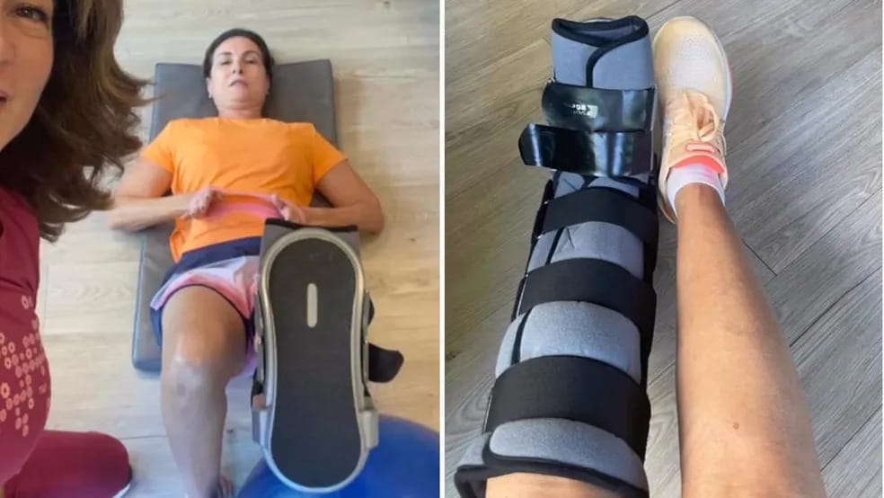 Com o pé quebrado, Fátima Bernardes exibe fisioterapia: “Não posso parar” - 2