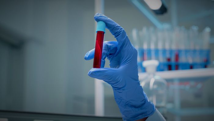 Exame de sangue consegue prever qual órgão vai falhar primeiro - 1