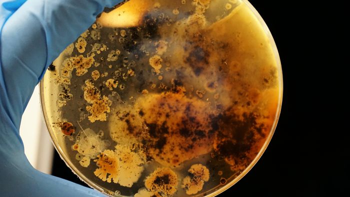 35 novas espécies de bactérias são descobertas em hospital - 1