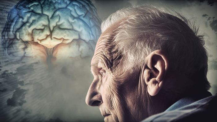 Doença de Alzheimer têm 5 variantes biológicas diferentes - 1