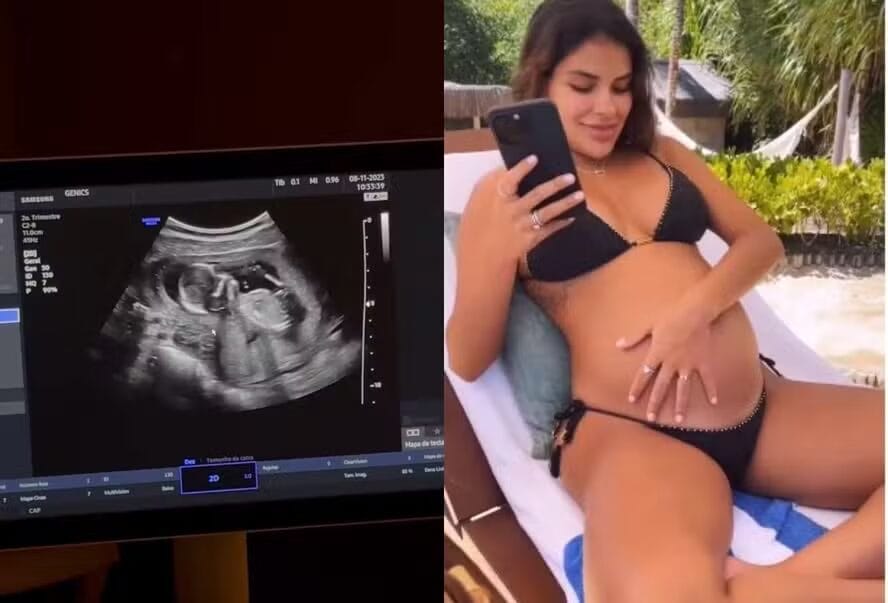 Grávida, Munik Nunes mostra ultrassom da primeira filha - 2