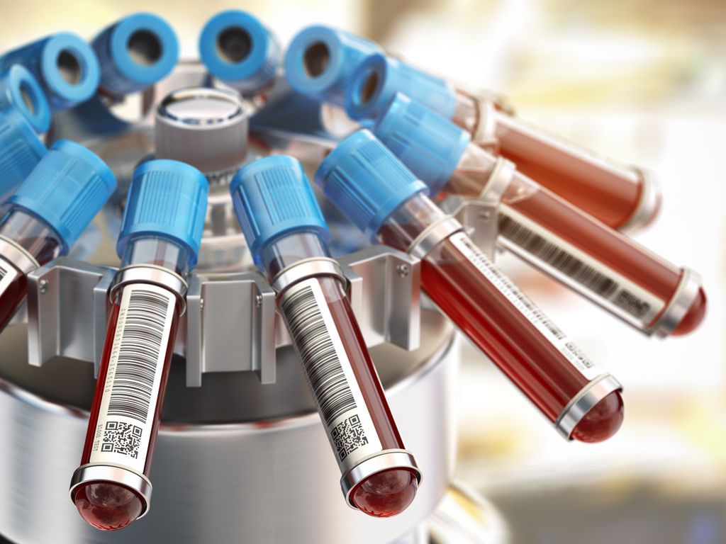 Novo exame de sangue detecta 18 tipos de câncer em fase inicial - 2