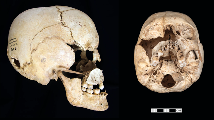 Primeira pessoa pré-histórica sem um cromossomo X é identificada - 1