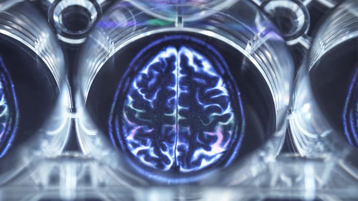Cérebro humano cresceu e ficou maior nos últimos 90 anos - 1