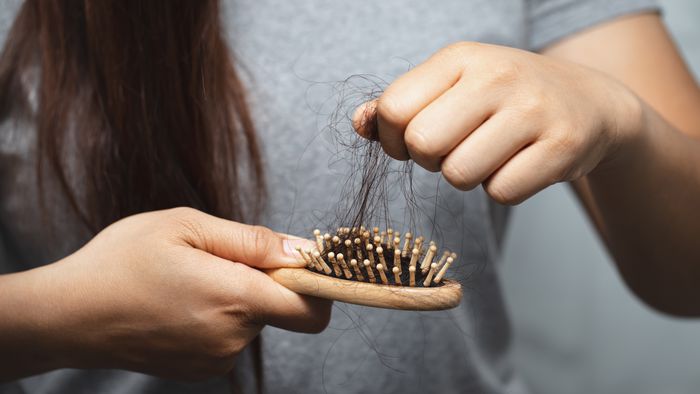 Como a dengue pode provocar queda de cabelo - 1