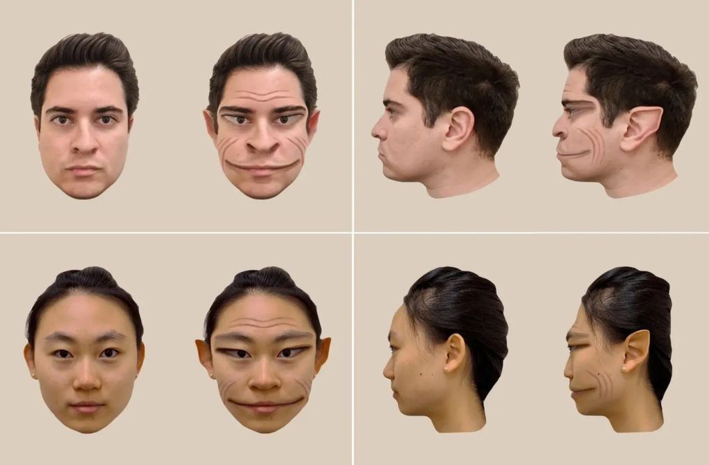 Condição neurológica faz homem enxergar pessoas como