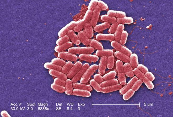 Nova classe de antibióticos elimina superbactérias e pode salvar milhões - 2